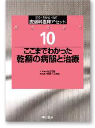 ここまでわかった乾癬の病態と治療